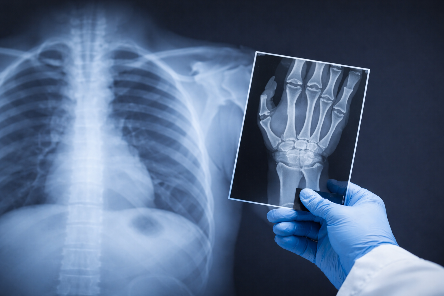 Digital X-Ray